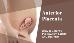 Anterior Placenta - Placenta Anterior - Placenta in front