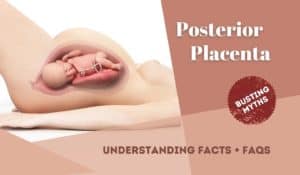 Posterior placenta