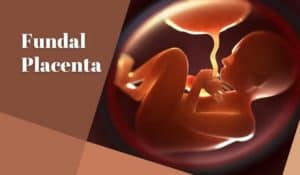 Fundal Placenta