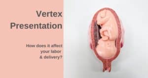 what is the meaning of vertex presentation in pregnancy