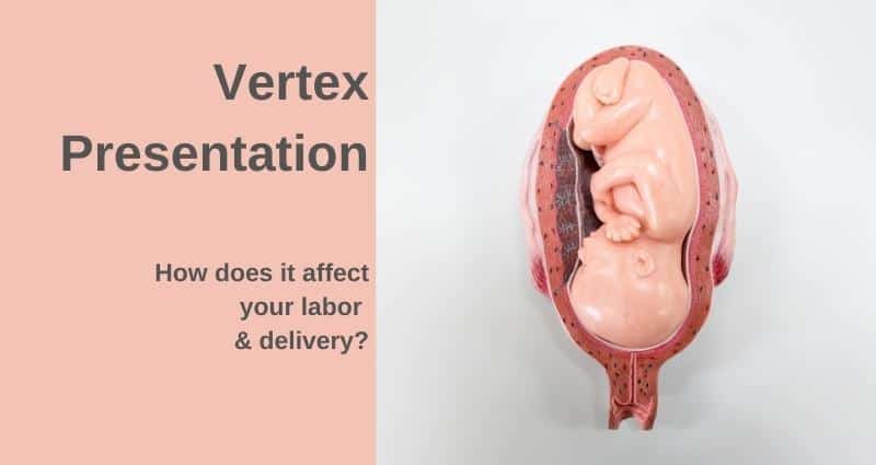 vertex presentation medical term definition