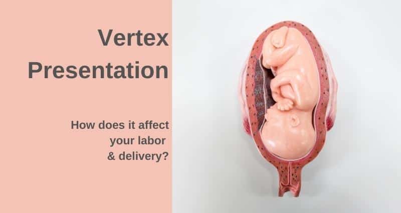 what means vertex presentation