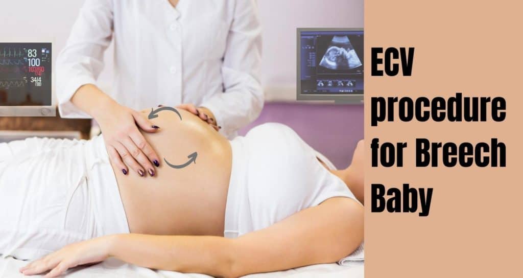 ECV Procedure