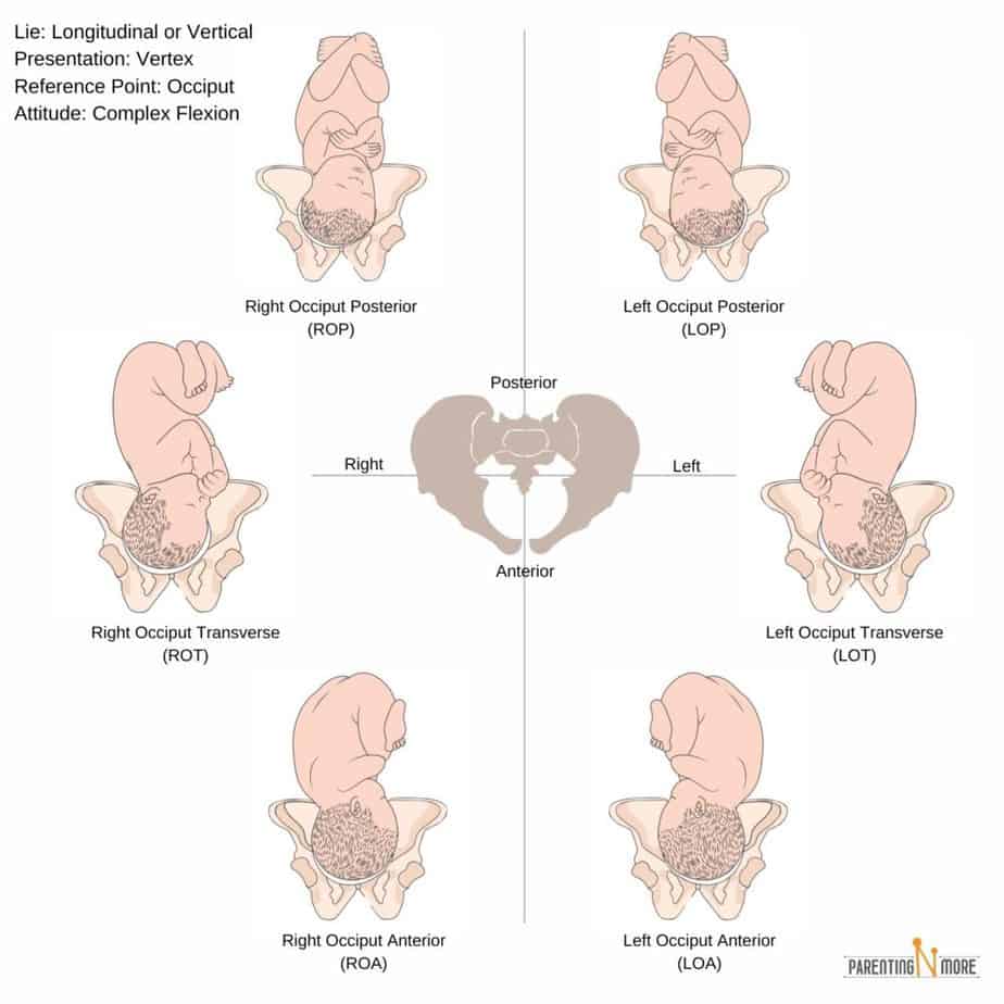 Fetal Lie (Baby Positions in Womb) - Chart