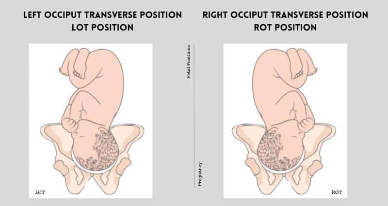 Left and Right Occiput Transverse