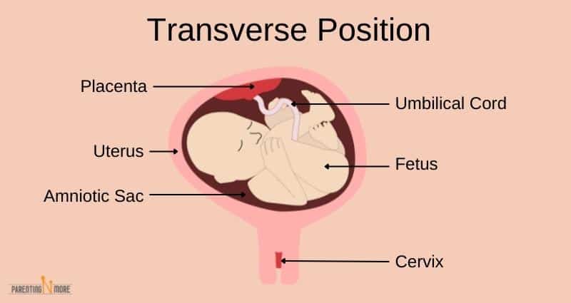 transverse face down baby