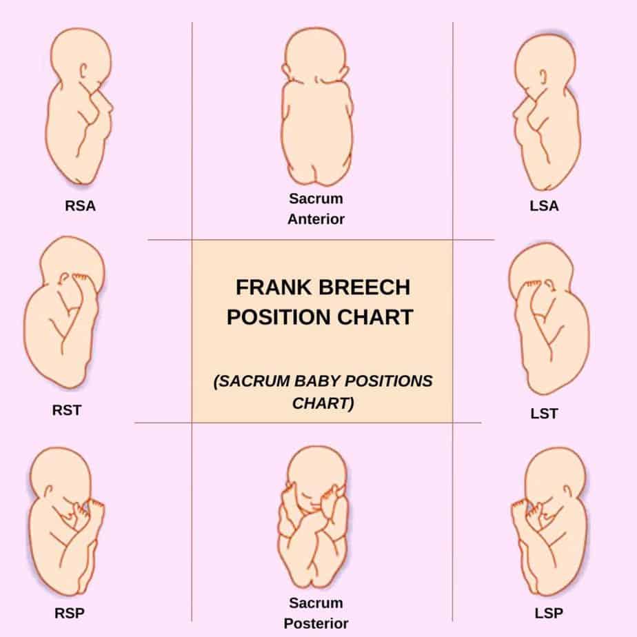 Frank Breech position Chart (Sacrum baby positions chart)
